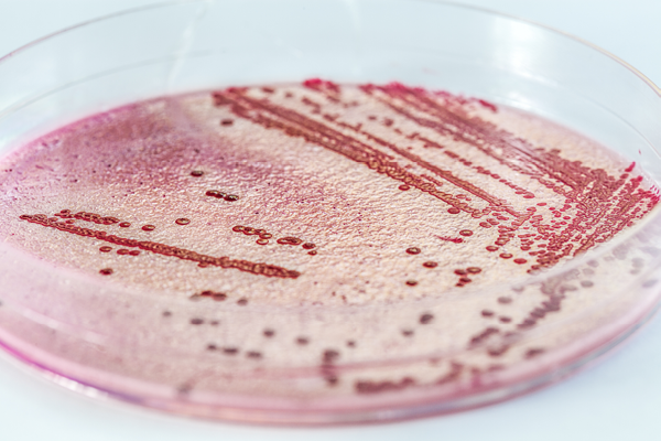 24-timers Listeria-analyse